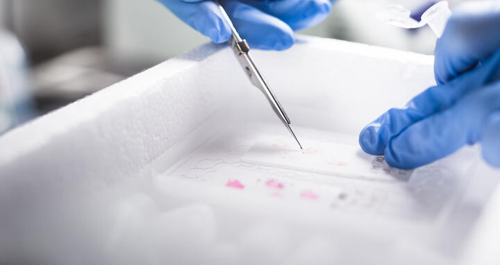 Preparation of the tumor tissue for sequencing