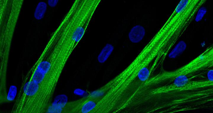Stammzellen verschmolzen zu mehrkernigen Fasern (Myotuben)