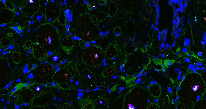 Cellular landscape of cardiac tissue