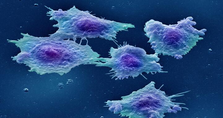 Human colon cancer cells