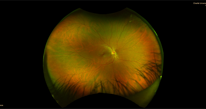Retinagefäße