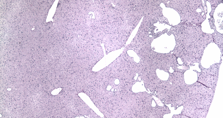 stained tissue sections of a mouse liver after base editing