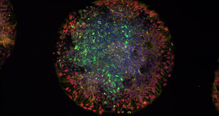 A day-old micropatterned organoid generated from induced pluripotent stem cells (iPSCs) derived from a patient with a mutation in the IRF2BPL gene. The different colors mark distinct cell populations, which reveal how the organoid is organizing into layers of developing neural tissue. It provides a snapshot of early human brain-like development in this patient-derived model.