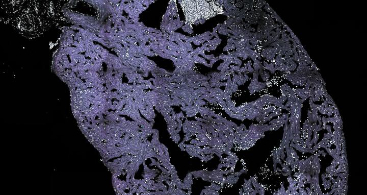 Zebrafish heart after cryoinjury
