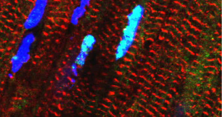 RBM20 protein in heart muscle cells shown in light blue.