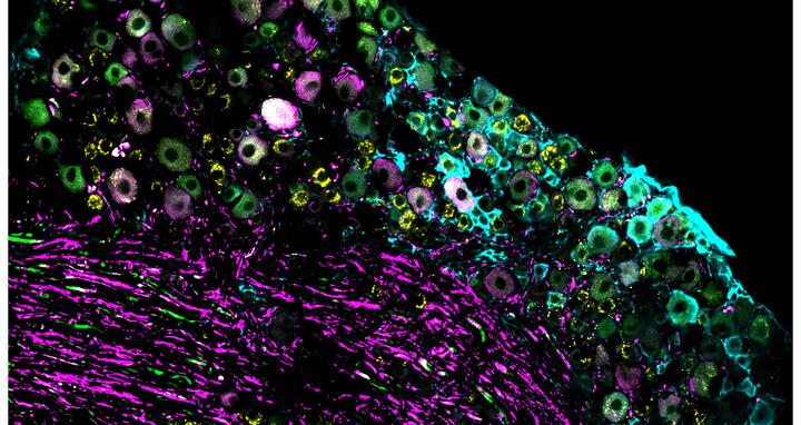 Cluster of mouse nerve cells