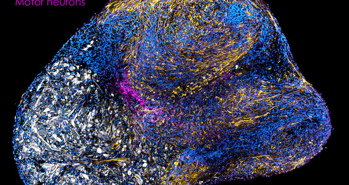 Neuromuscular organoids
