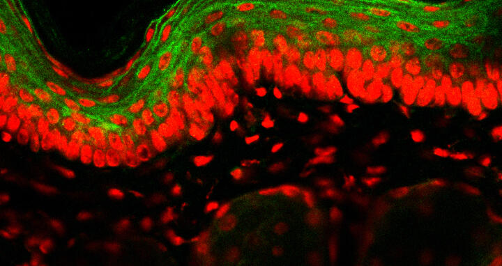 Cross-section of the skin