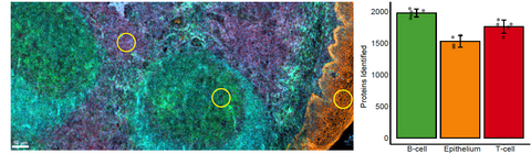 SpatialProteomics_Tonsil.png