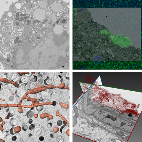 Examples of different EM methods used to visualized cellular features as mitochondria (bottom left) and the plasma membrane (bottom right).
