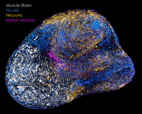 Neuromuscular organoids