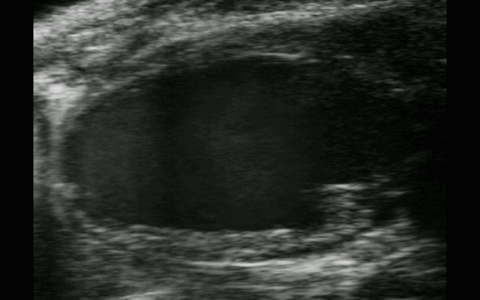Dating Blut auf mri