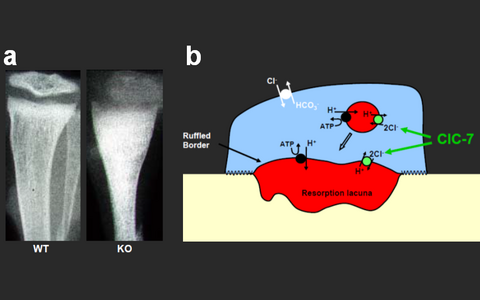 the picture shows x-eays of bones of wild type and ClC-7 knockout mice with hypercalcification in the knockout. Besides is a model graph for the acidification of the osteoclast resorption lacuna.