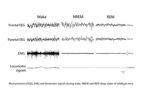 Neurologger_Signals