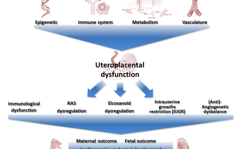 Pregnancy Complications Müller Dechend Lab