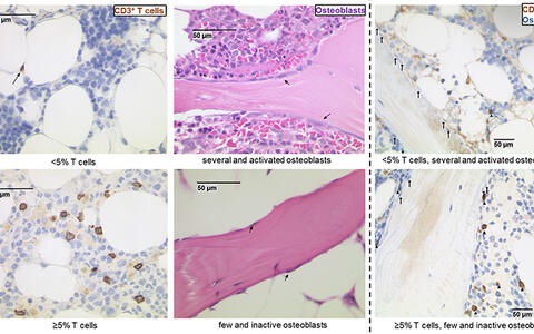 AG Na Fig2 Bone Marrow GVHD