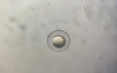A few hours old zebrafish egg under the microscope, in the laboratory of Daniela Panáková