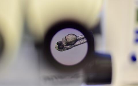 Zebrafish embryo under the microscope