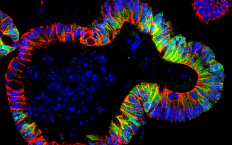 Is that a mini-pig in the Petri dish or a symbol of hope for colon cancer therapy?