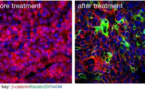 cancer_stemcells_EN