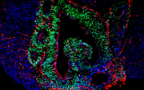 Brain organoids