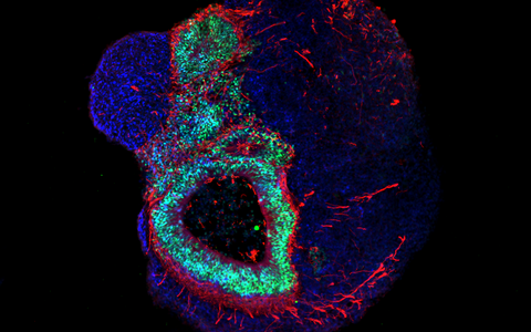 Organoid Gehirn