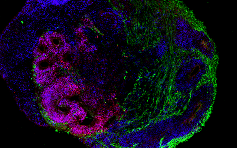 Organoid Gehirn