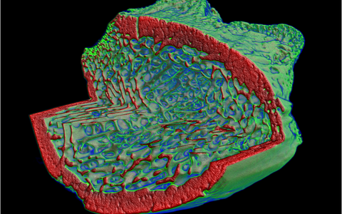 3D-Schnittbild durch die Epiphyse eines Rattenschienbeins mit Darstellung der medullären Trabekelstrukturen