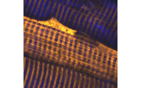 Structures of unlabeled striated muscle in living mouse