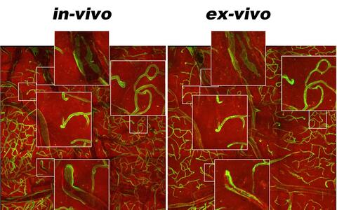 Korrelation der In-vivo- und Ex-vivo-Aufnahmen des Hirn-Kortex einer trangenen Maus, die grüne und rote Fluoreszenzproteine in verschiedenen Zelltypen exprimiert