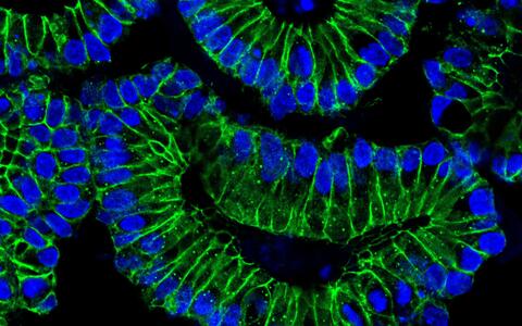 colon organoids