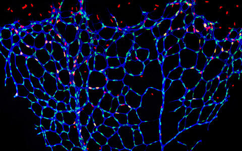 Retinal blood vessels