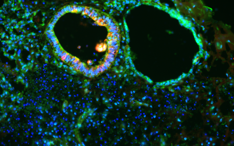 mikroskopische Aufnahme eines SURF1 Organoids