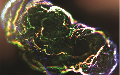 Heart and brain organoid