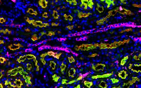 microscopic image of a mouse kidney