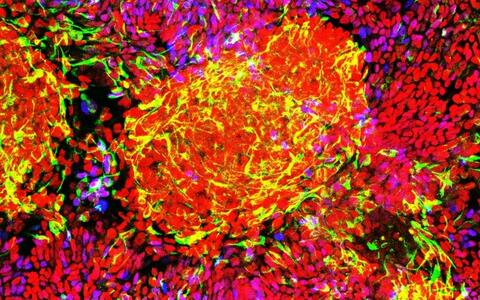 Muscle precursor cells