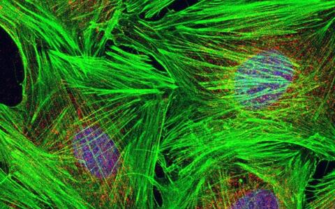 Skeletal muscle fiber precursor cells