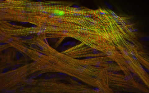 View into the heart muscle of a zebrafish