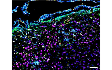 magnetic nanoparticles and immune and glia cells in the mouse brain