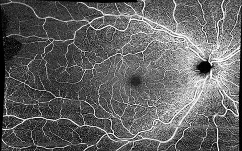 Hanna Zimmermann Aufnahmen der Netzhaut