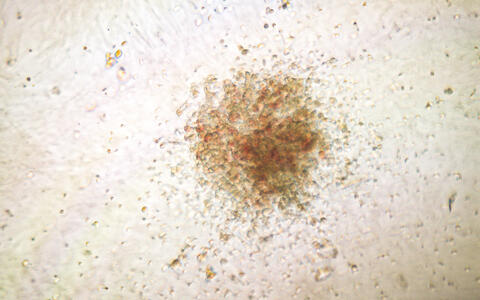 Wissenschaftliches Bild: Kolonie von menschlichen blutbildenden Stammzellen