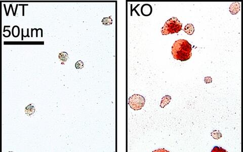 Alveolarmakrophagen im Vergleich (links aus Wildtyp Mäusen; rechts aus Cebpb-defizienten Tieren)