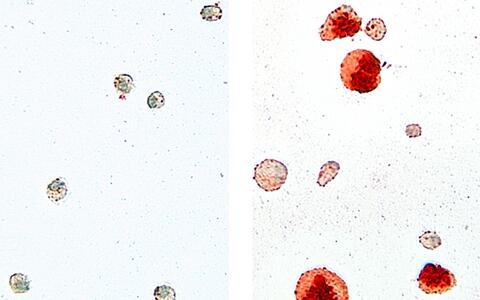 Makrophagen: Vergleich WT und Mutante