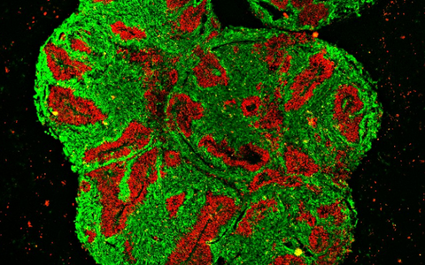 Mikroskopische Querschnitt-Aufnahme eines Nashorn Hirn-Organoids