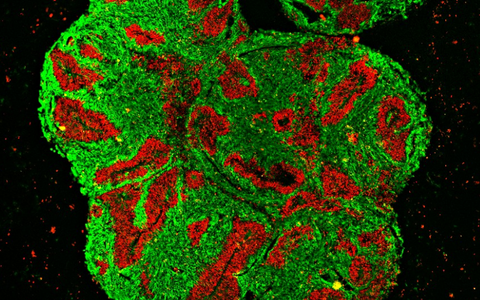 Microscopic cross-sectional image of a rhinoceros brain organoid.