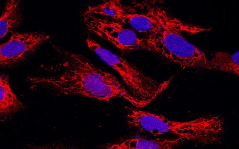 HeLa cells