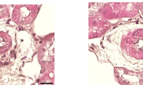 Scientific imaging of the vascular walls of two kidneys