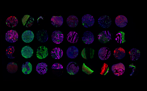 TMA_Multiorgan