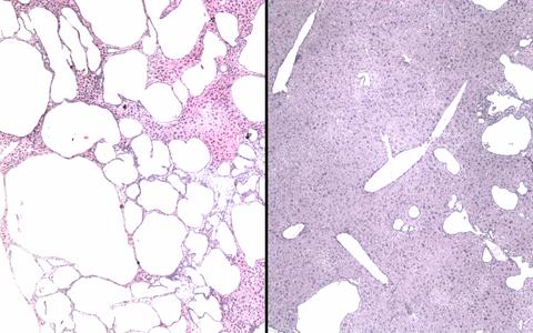 stained tissue sections of a mouse liver before and after base editing