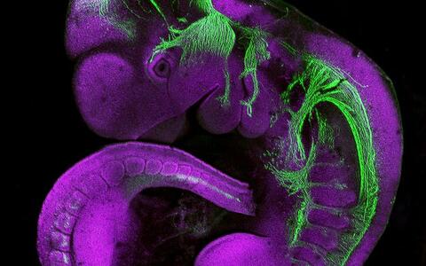 Signal transduction in development and carcinogenesis